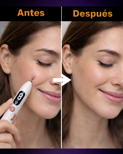 SkinFix - Removedor Verrugas Y Lunar